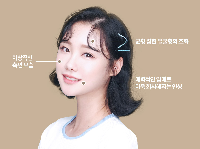 돌출입 정확한 진단으로 확실하게 개선하는 것이 중요! 관련 이미지 6