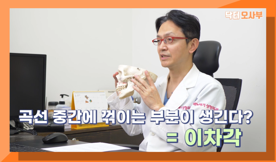 사각턱수술 부작용? 이차각? 닥터오사부랑 제대로 알아보자! 관련 이미지 4