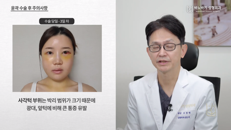 윤곽수술 후, 이 과정을 거쳐야만 좋은 결과가 나옵니다! 관련 이미지 3