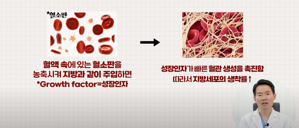 지방이식하면 피부가 좋아진다? 관련 이미지 2