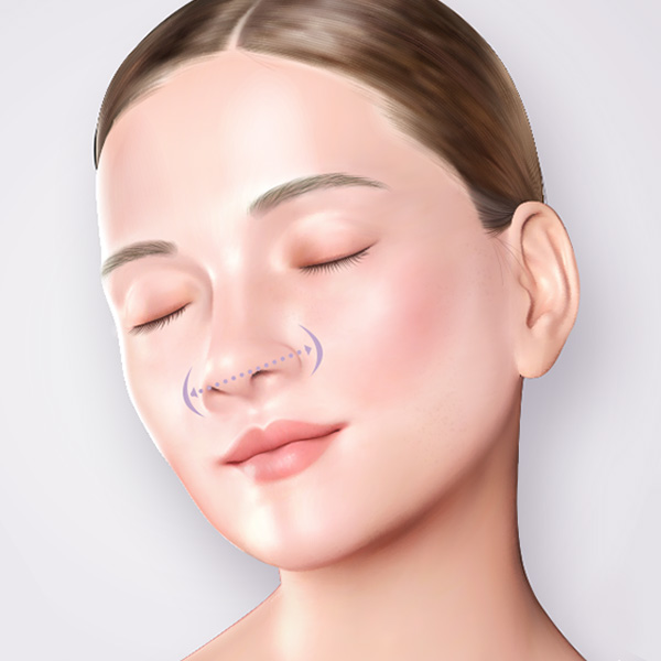 복코 성형, 뭉툭한 코를 세련되고 슬림한 코로 개선 관련 이미지 2