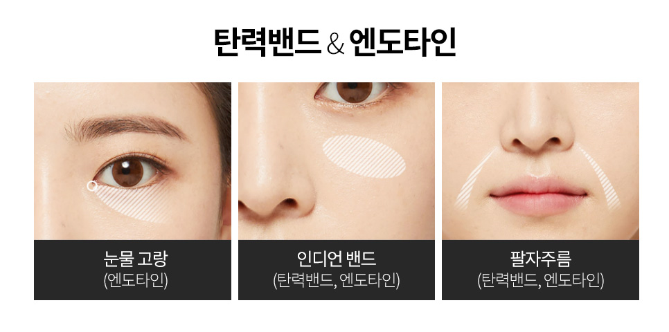 광대 수술 피부 처짐 없이 자연스럽게 개선 가능할까? 관련 이미지 5