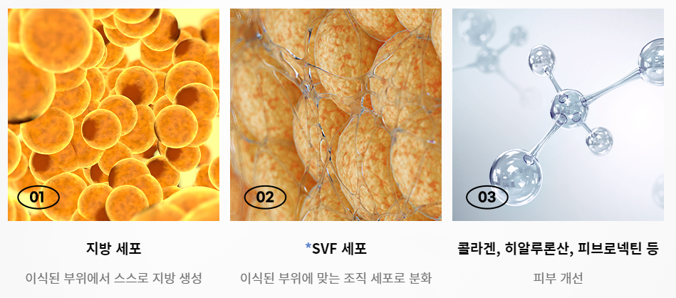 오래가는 아름다움, 줄기세포 지방이식 관련 이미지 4