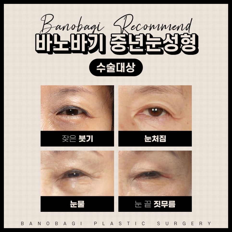 중년눈수술 중년눈성형은 경험이 풍부한 전문의에게! 관련 이미지 2