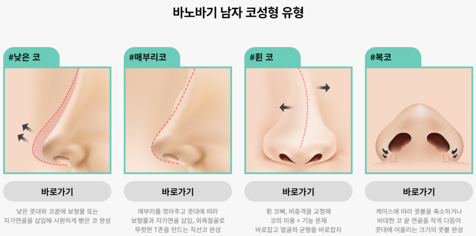 잘생김의 시작, 남자 코성형 관련 이미지 4