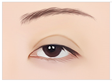 눈재수술, 더 이상 망설이지 마세요! 관련 이미지 7