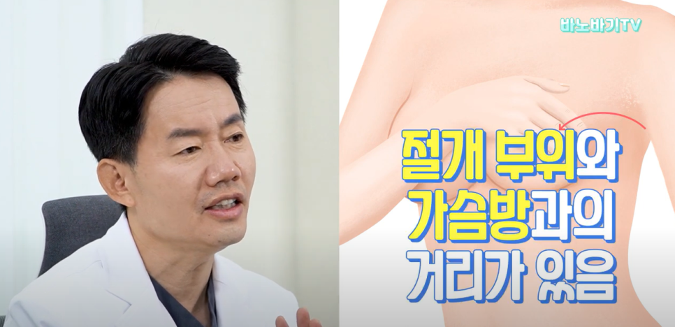 가슴 수술 절개 부위는 어디가 좋을까? 겨절,밑절의 장단점 총정리! 관련 이미지 3