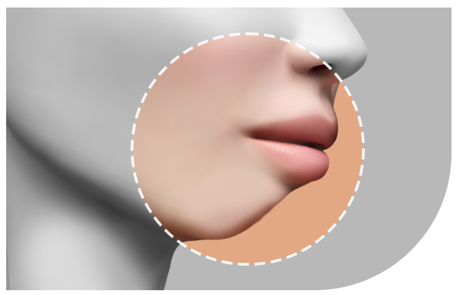 안전하고 자연스럽게, 무턱 양악수술 관련 이미지 2