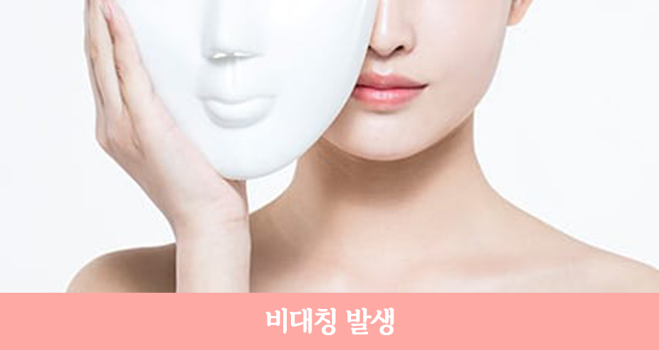 안면거상 재수술, 정확한 원인 분석으로 확실한 개선! 관련 이미지 5
