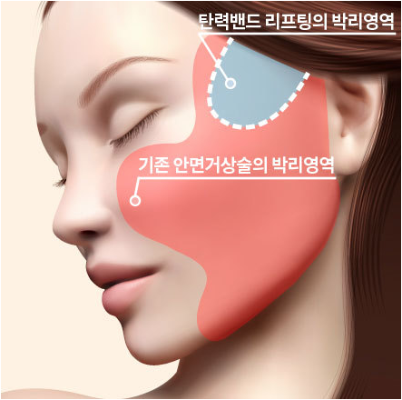 얼굴의 근막층을 강화시키는 바노바기 탄력밴드리프팅 관련 이미지 5