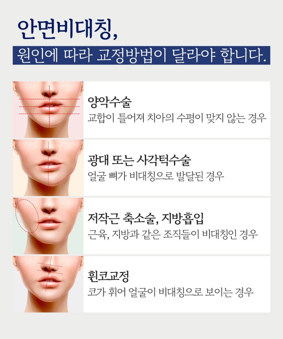 안면비대칭, 정확한 원인 분석으로  한 번에 개선 관련 이미지 6