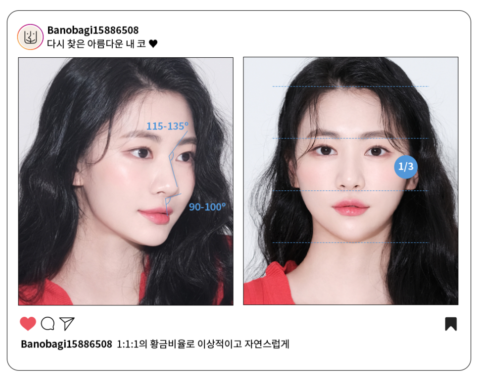 마지막 코재수술, 바노바기에서! 관련 이미지 2