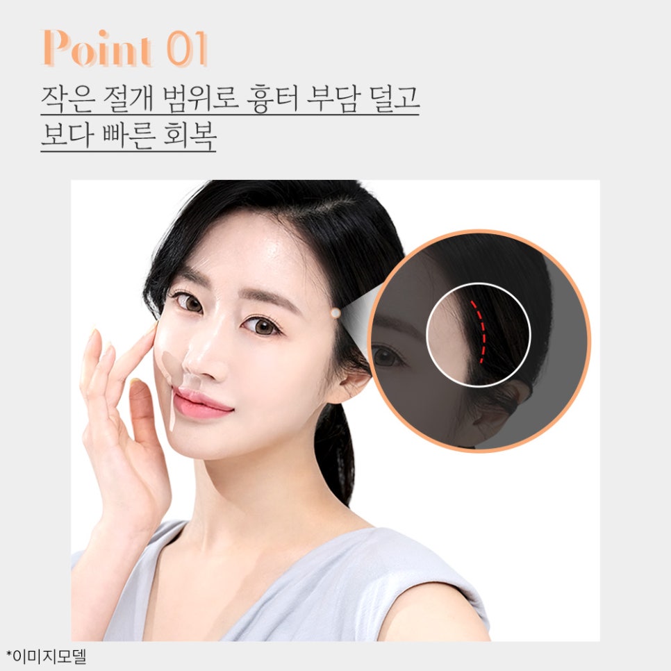 피부 탄력, 이중턱, 주름 한 번에 개선하는 미니V리프팅 관련 이미지 5