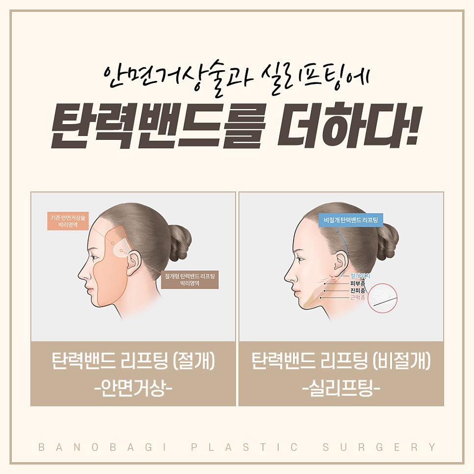 바노바기 탄력밴드 리프팅으로 더 오래가는 자연스러운 젊음 관련 이미지 4