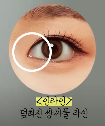 쌍꺼풀 라인의 종류와 나에게 어울리는 라인 찾기! 관련 이미지 4