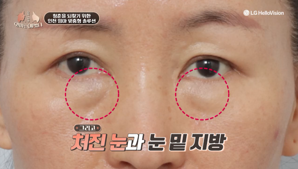 엄마는 예뻤다 12화 - 인천 엄마의 뷰티 솔루션 관련 이미지 10