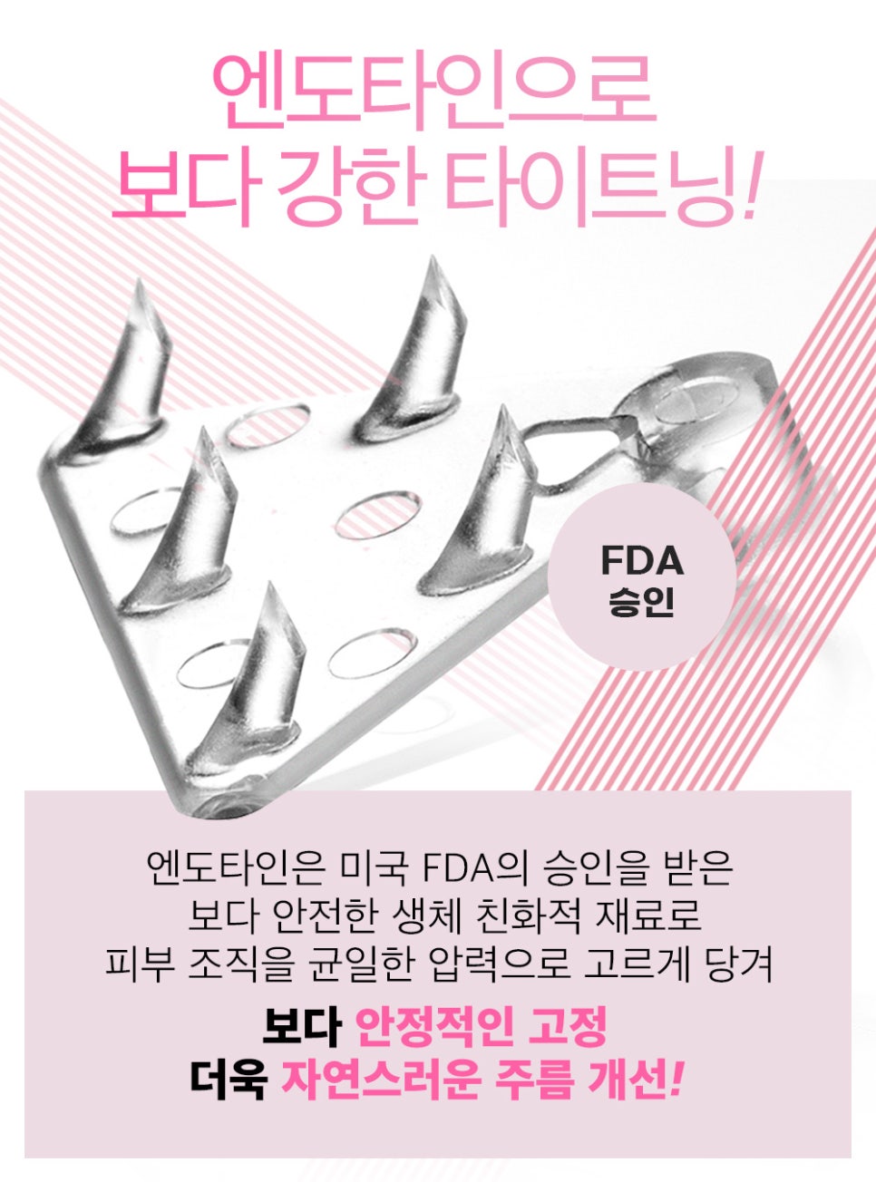 중안면부 리프팅 수술법과 엔도타인의 장점 관련 이미지 3