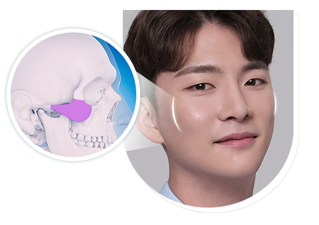 차별화된 방법으로 접근하는 남자 안면윤곽 관련 이미지 7