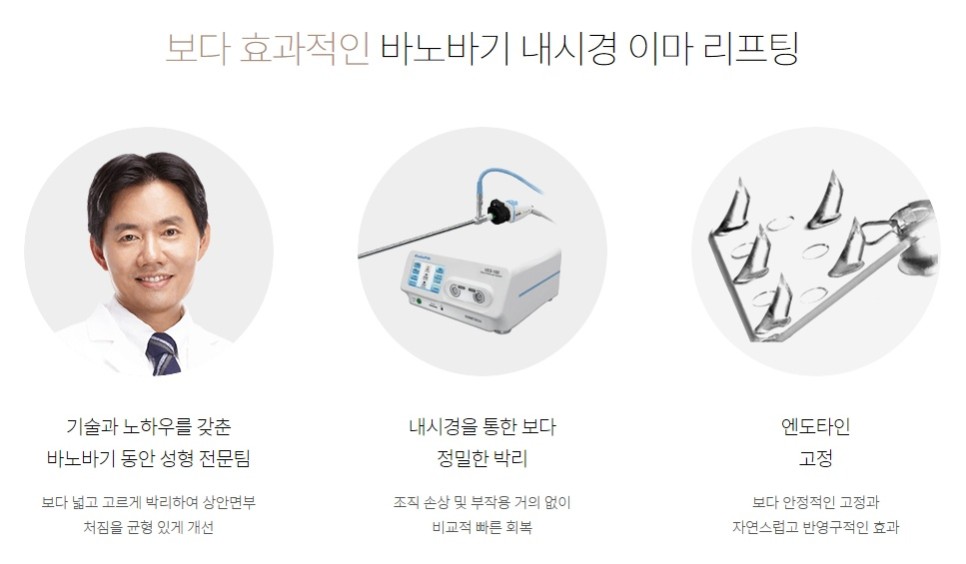 내시경 엔도타인 이마 리프팅으로 더욱 밝아지는 인상! 관련 이미지 6