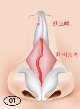 휘어진 콧대와 코 속을 한 번에 바로잡는 휜코 성형 관련 이미지 5