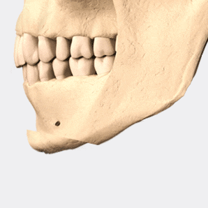 앞턱 수술, 얼굴형과 조화를 이루는 턱 선이 작은 얼굴을 결정짓는다. 관련 이미지 6