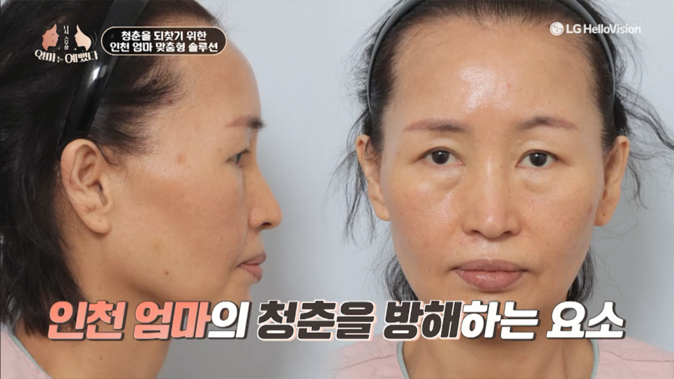 엄마는 예뻤다 12화 - 인천 엄마의 뷰티 솔루션 관련 이미지 12