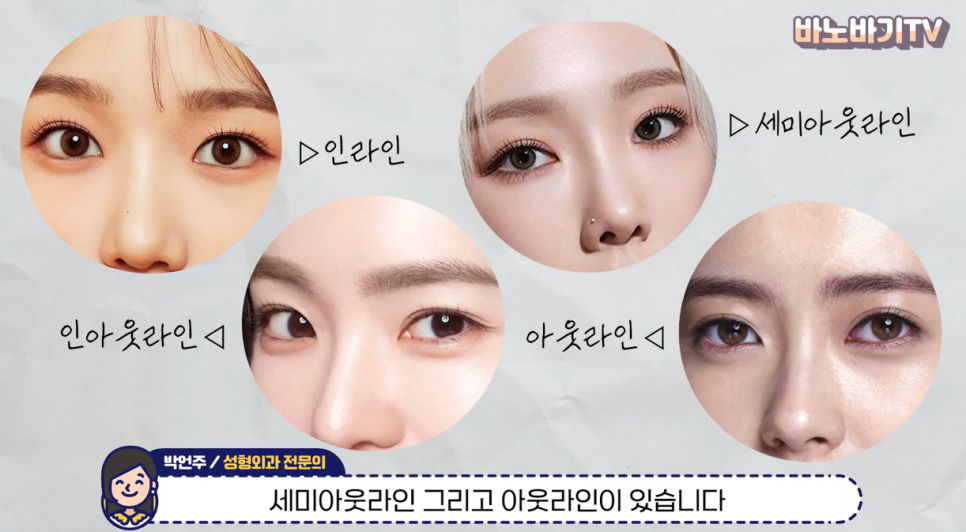 쌍꺼풀 라인의 종류와 나에게 어울리는 라인 찾기! 관련 이미지 2