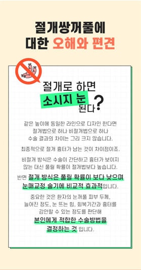 절개가 오히려 자연스러울 수 있다? 바노바기 쌍꺼풀수술 알아보기! 관련 이미지 2