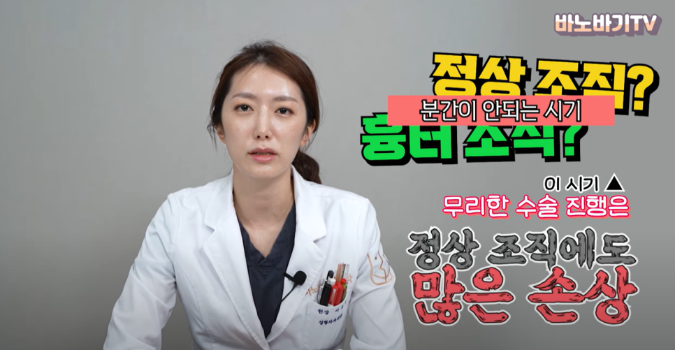 코 재수술에 대한 궁금증을 풀어드려요(구축, 염증, 재수술 시기) 관련 이미지 4