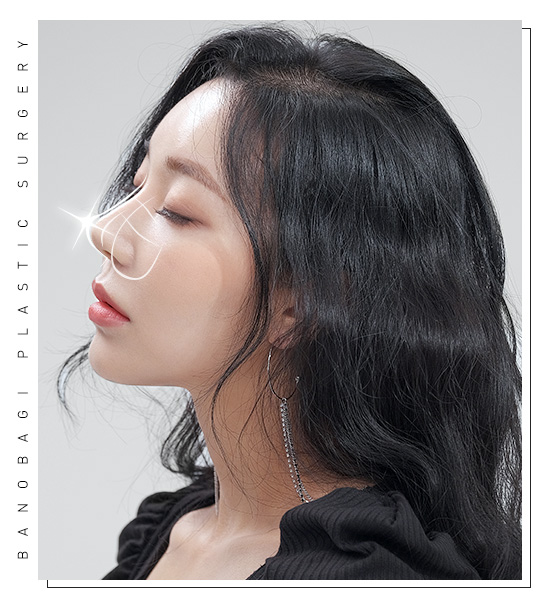 복코 성형, 뭉툭한 코를 세련되고 슬림한 코로 개선 관련 이미지 3