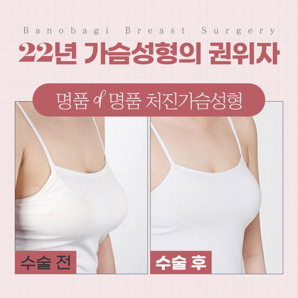 처진 가슴, 케이스에 따른 맞춤 개선으로 탄력 있고 볼륨감 있는 가슴으로! 관련 이미지 10