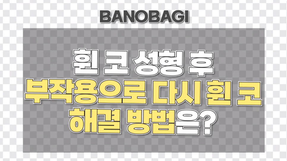 휜코성형 성공하는 꿀TIP! 관련 이미지 4