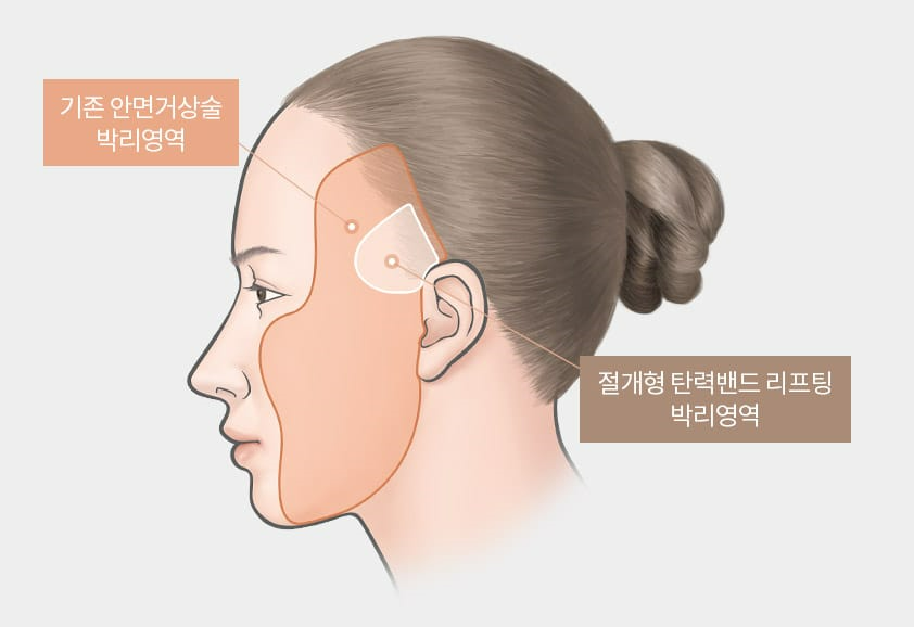 탄력밴드 리프팅으로 더 오래가는 자연스러운  젊음 관련 이미지 4