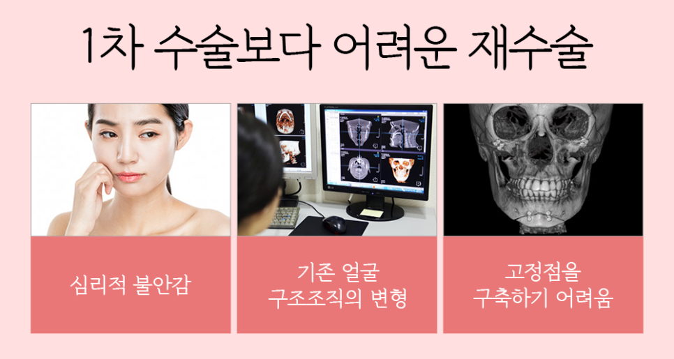 윤곽 재수술의 다양한 원인과 개선 방법! 관련 이미지 2