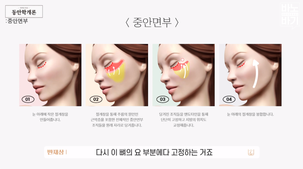 동안을 결정짓는 &lsquo;중안면부&rsquo; 노화 개선 방법! 관련 이미지 5