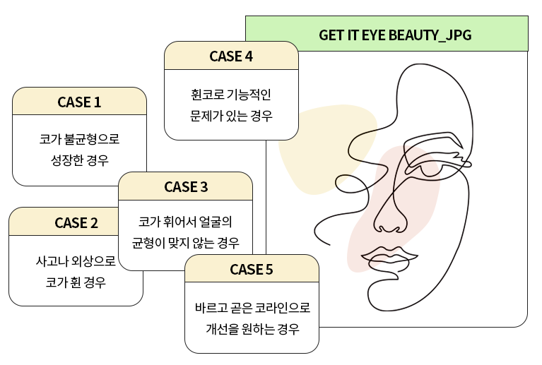 휜코, 바르고 곧은 코라인으로! 관련 이미지 2