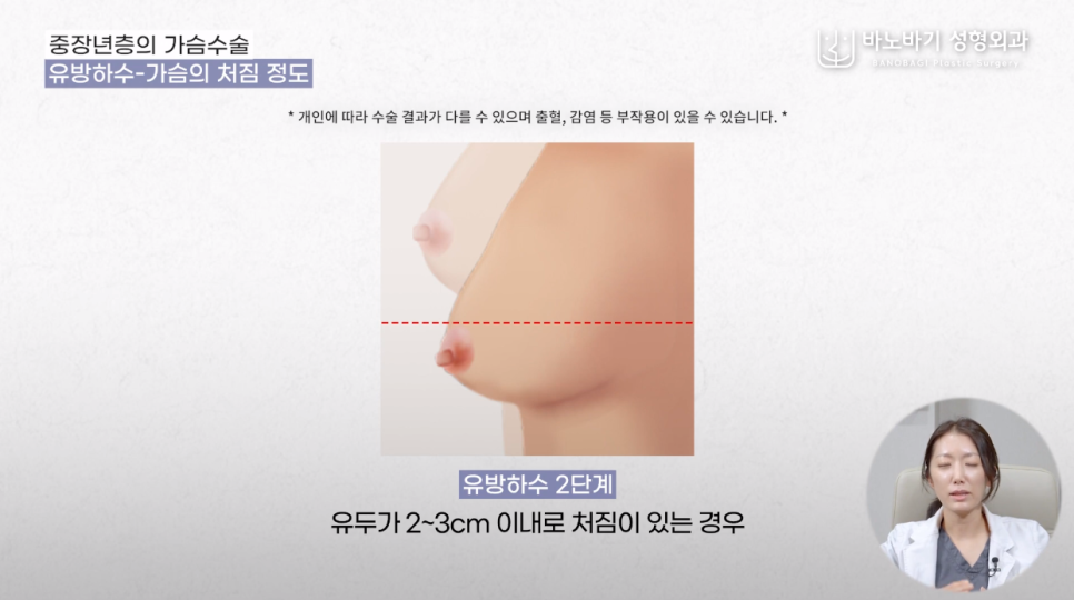 당신의 가슴은 원래 예뻤다, 중년 가슴성형 파헤치기! 관련 이미지 5
