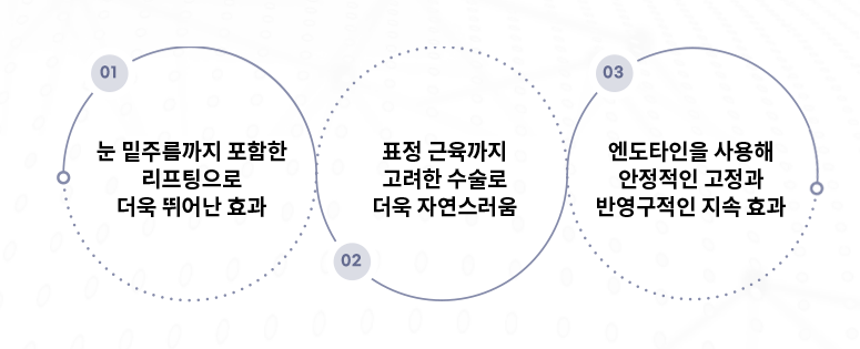 중안면부 리프팅으로 눈 밑 주름, 팔자주름까지 한 번에! 관련 이미지 4