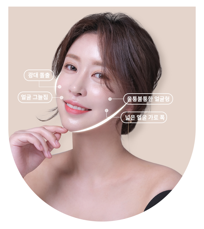 광대축소술로 작고 부드러운 얼굴형 GET! 관련 이미지 2