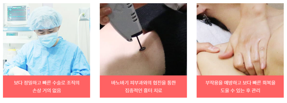 불만족의 분석과 개선, 가슴재수술 관련 이미지 9