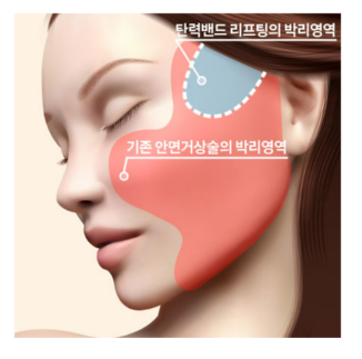 바노바기 탄력밴드 리프팅의 특징과 장점 관련 이미지 5
