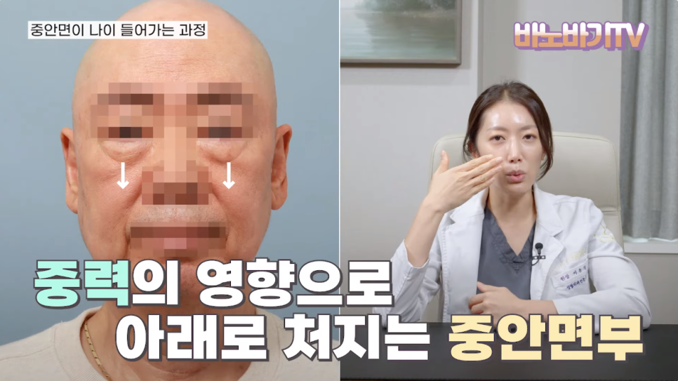 동안이 되고 싶다면? 중안면부를 잡아라! 관련 이미지 2