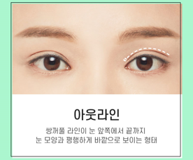 절개가 오히려 자연스러울 수 있다? 바노바기 쌍꺼풀수술 알아보기! 관련 이미지 4