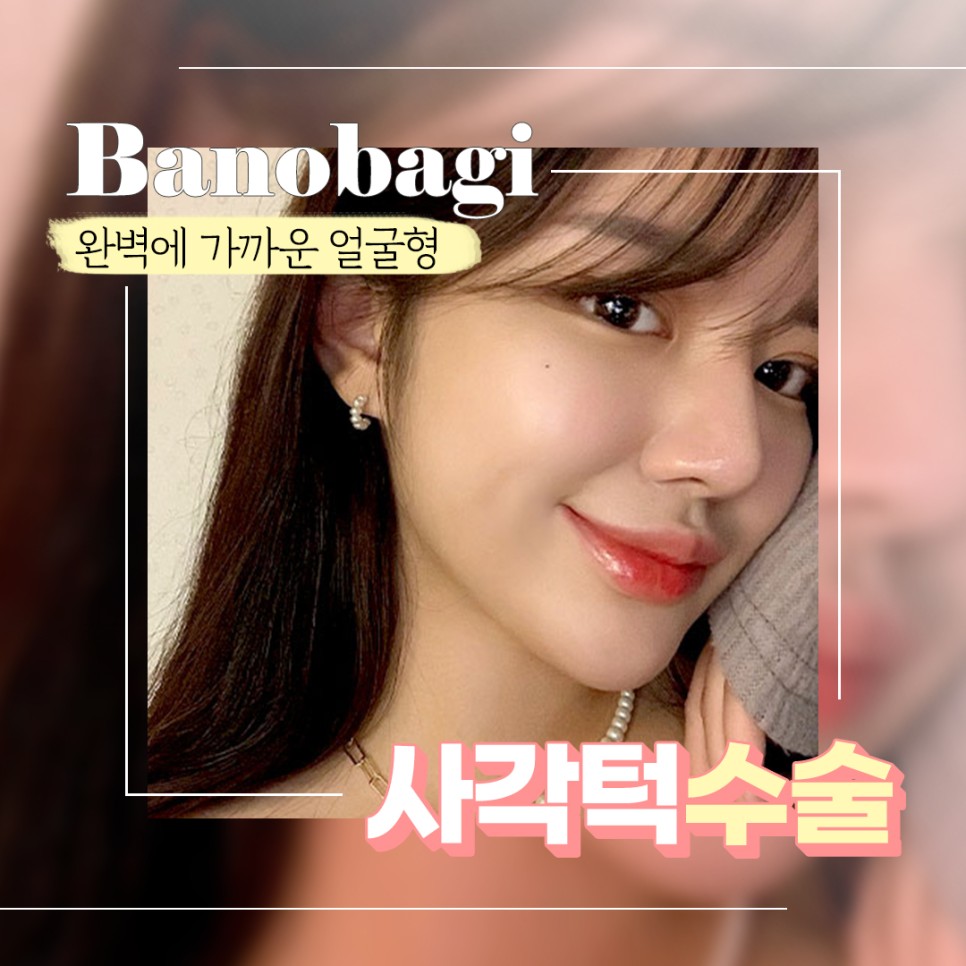 나에게 맞는 사각턱 수술 방법 찾기! 관련 이미지 1