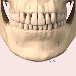 황금비율이란? 앞턱에 따라 달라지는 얼굴 비율 관련 이미지 6