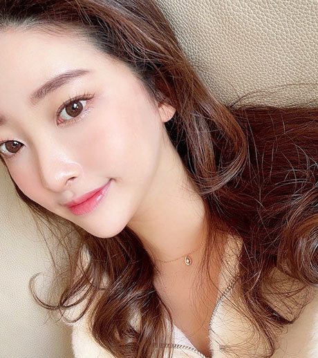 코성형보형물 코재수술 부작용이 있다면? 설명드립니다. 관련 이미지 2