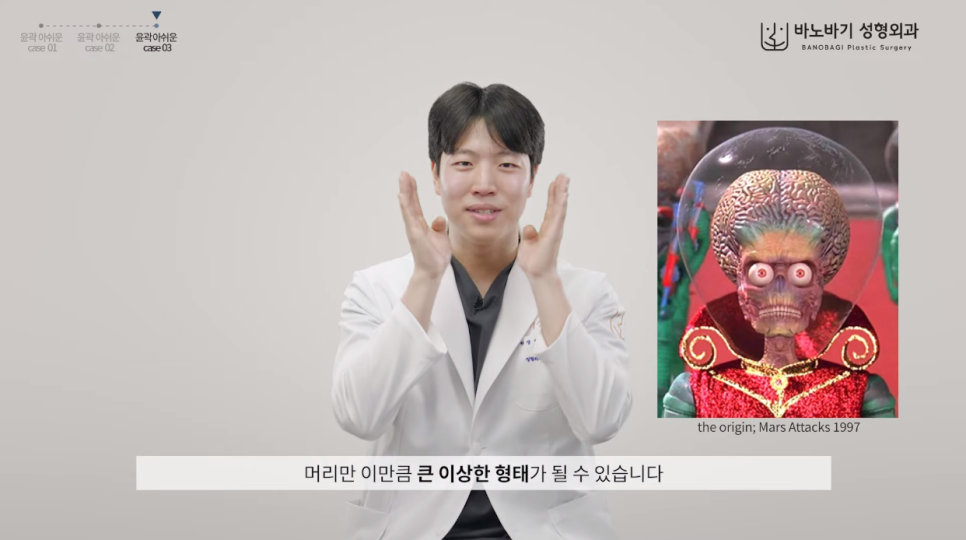 윤곽수술 최악의 부작용은? 이런 분들은 수술 금지! 관련 이미지 6