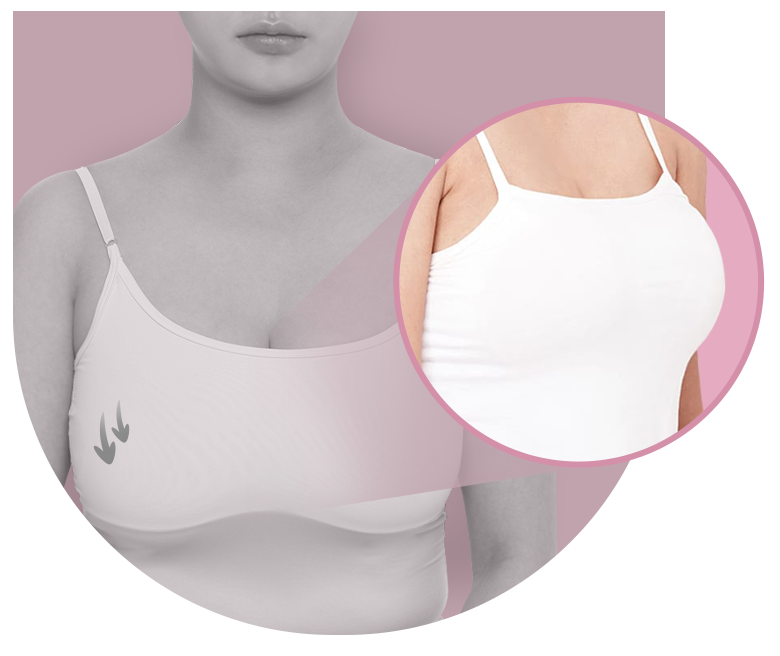 처진 가슴, 맞춤 개선으로 자신감 UP 관련 이미지 2