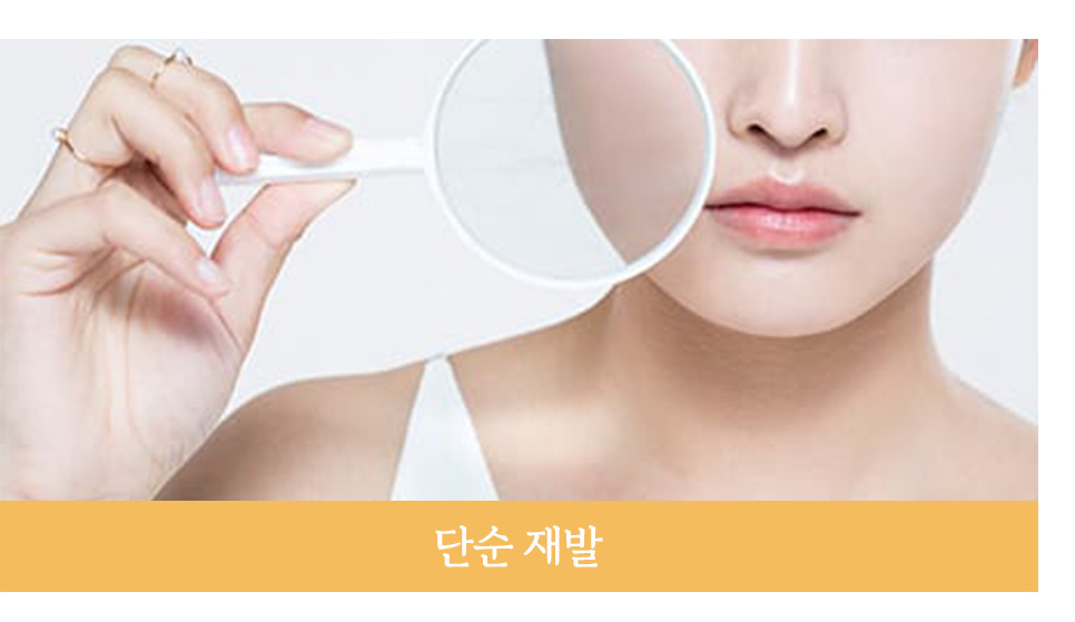 동안 재수술의 다양한 원인과 재수술 시기 관련 이미지 6