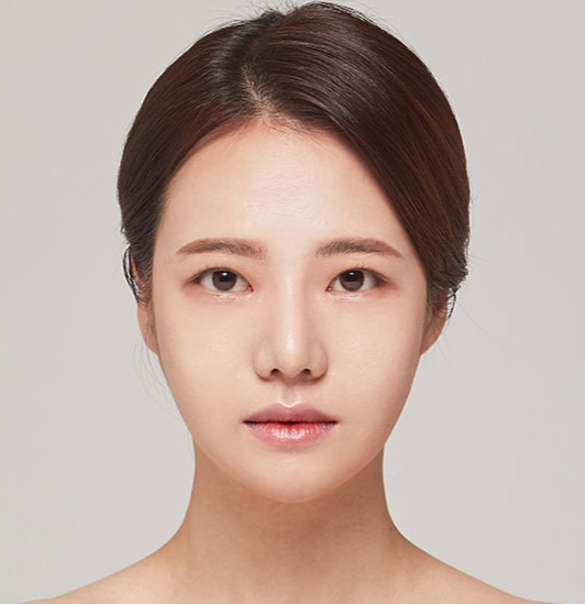 광대축소전후 22년 경력의 전문의의 실력, 궁금하신가요? 관련 이미지 5